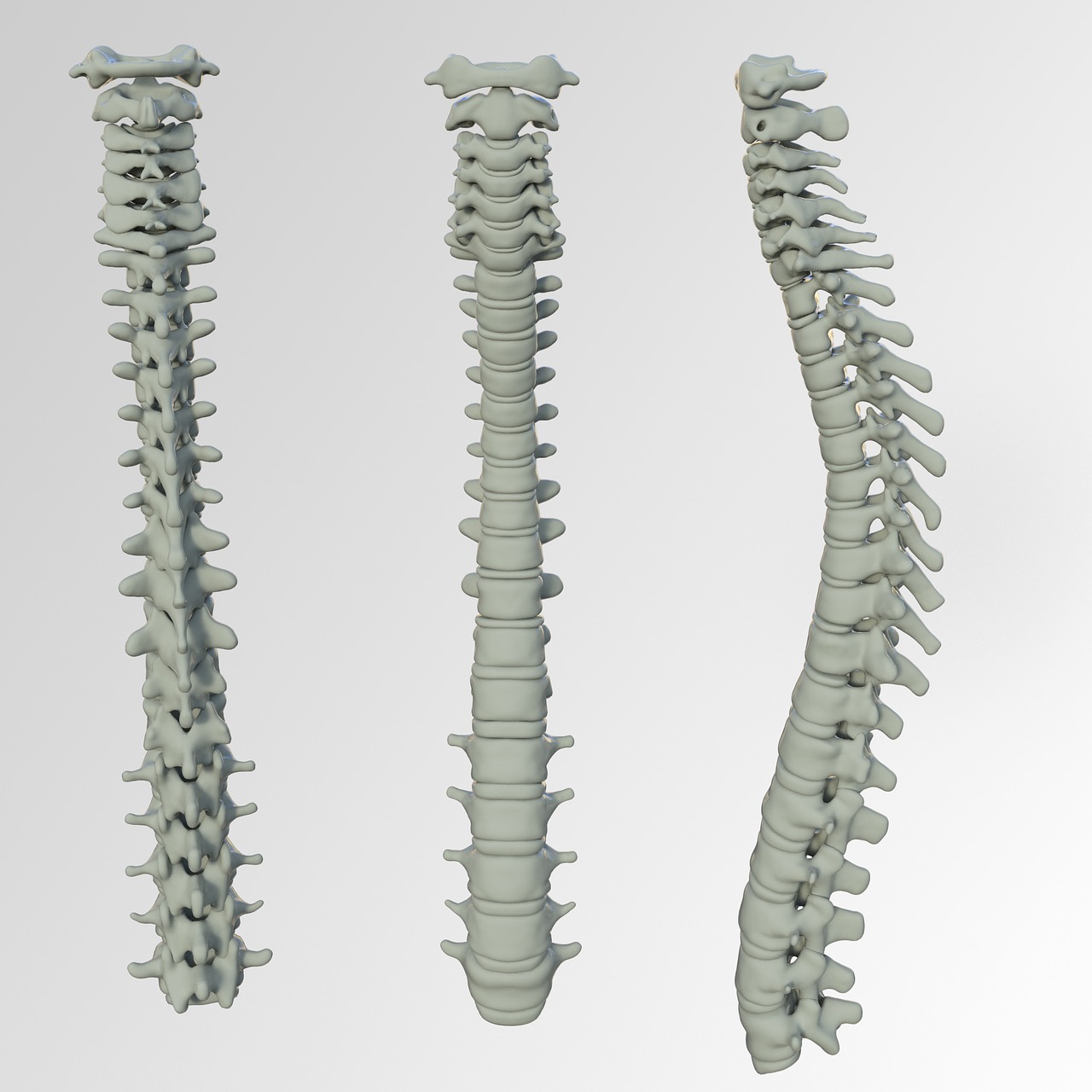 Spinal Screenings  Superior, WI 